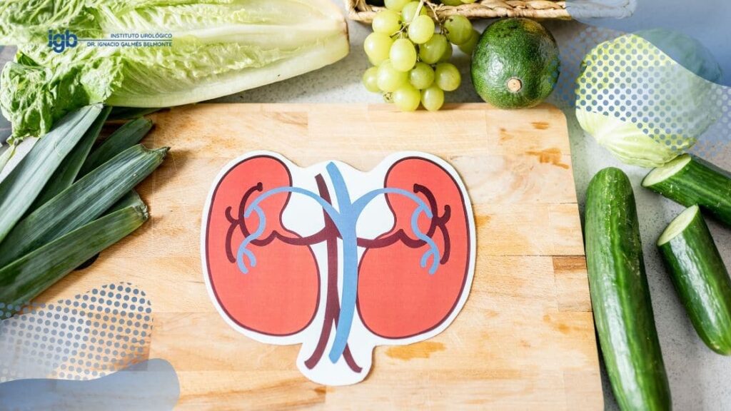 qué comer si tienes piedras en el riñon