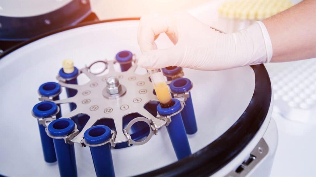 IGB TRATAMIENTO PRP ÁCIDO HIALURÓNICO