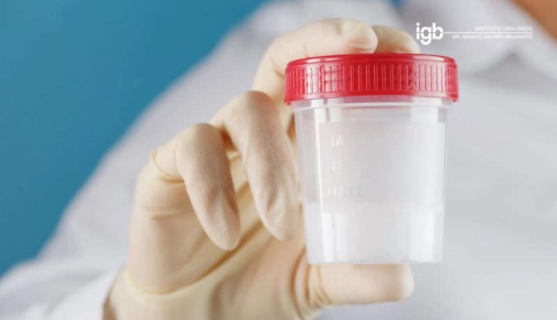 azoospermia ausencia de espermatozoides